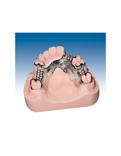 PROTECHNO - ESCAYOLA RUBINIT 18KG ROSA. TIPO IV 2