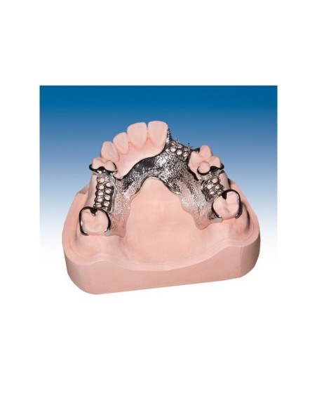 PROTECHNO - ESCAYOLA RUBINIT 18KG ROSA. TIPO IV